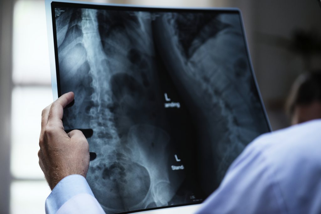 a doctor with a patient s x ray film 2022 09 16 07 25 45 utc