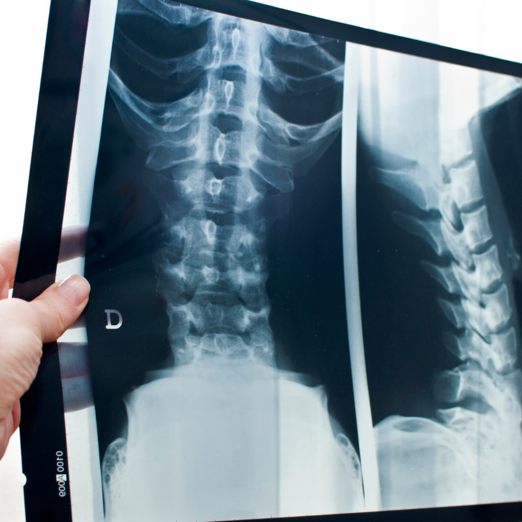Best Diagnosis for Pain